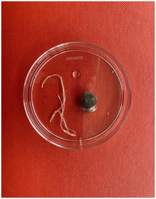 The long-distance relationship between Dirofilaria and the UK: case report and literature review